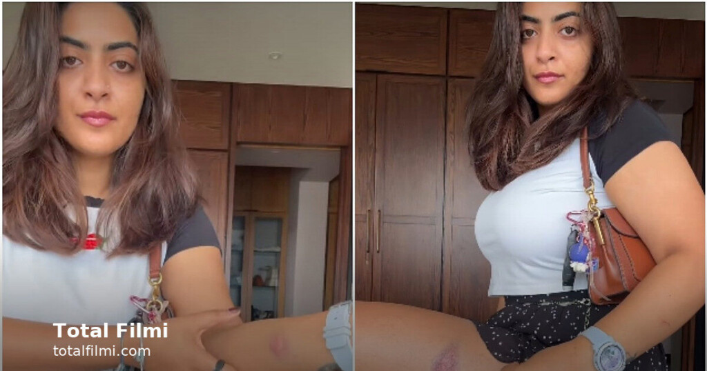 Aamir Khan's niece shows injury marks after Mumbai detention