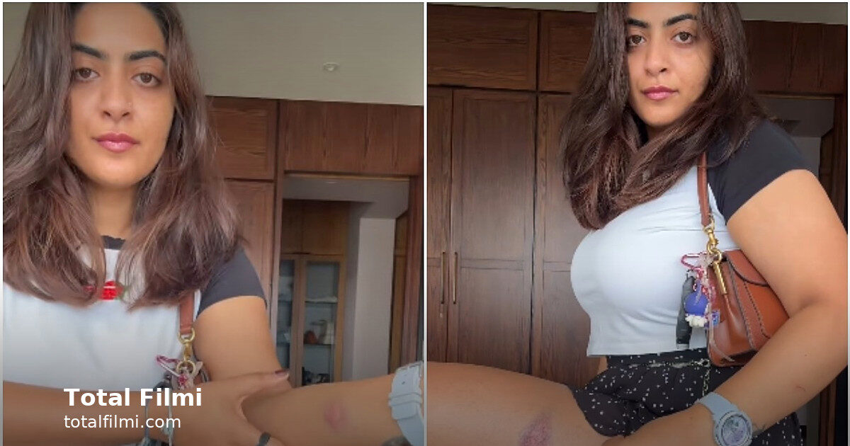 Aamir Khan's niece shows injury marks after Mumbai detention